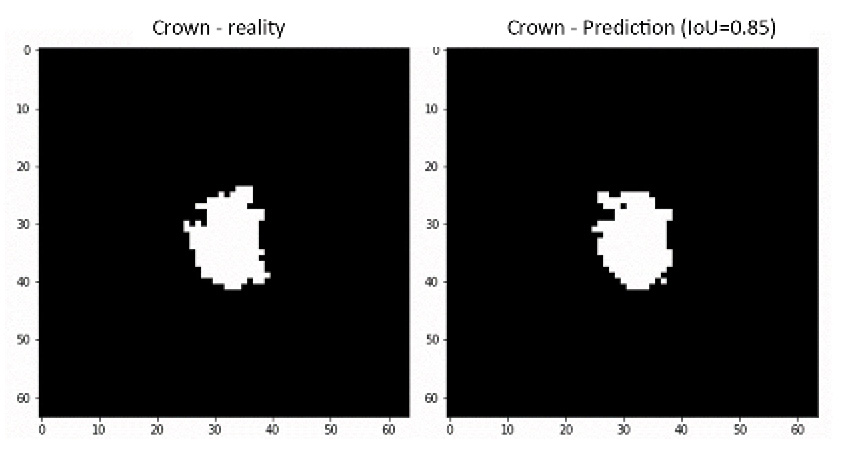 Figure5 Segmentation Step2